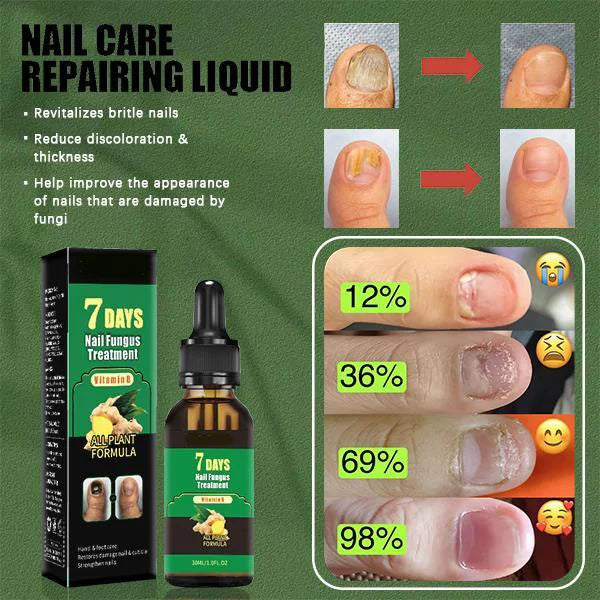 Tratamiento de uñas – Cuidado antifúngico natural 