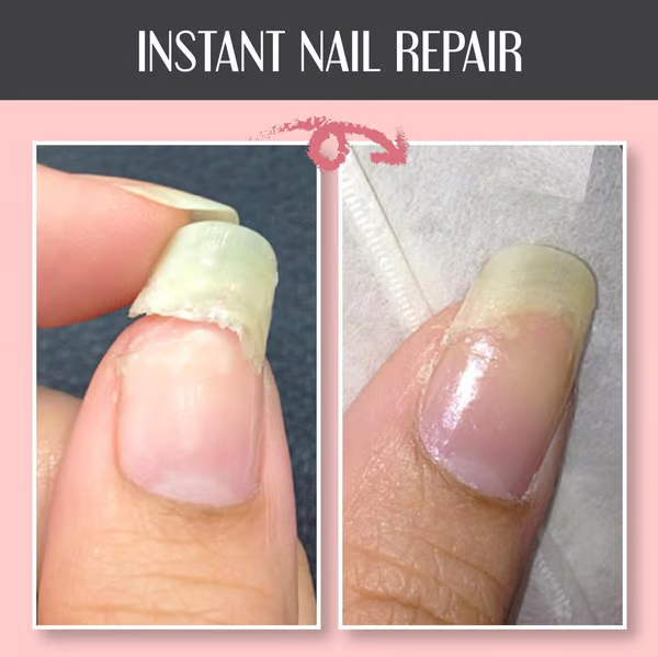 Gel Reparador y Protector para Uñas: Refuerza y Regenera 