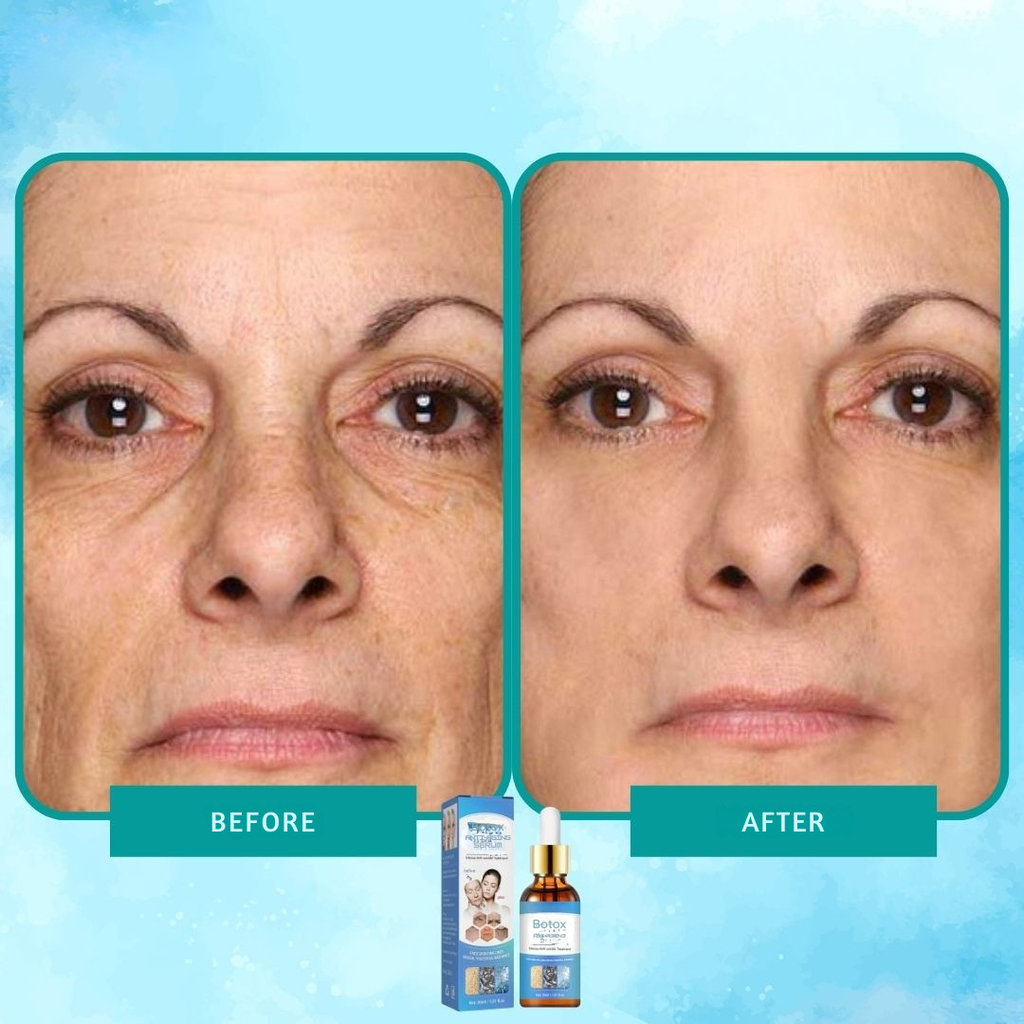 Botox-Serum intensives Anti-Falten-Elixier 